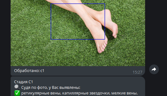 Пример AI-диагностики